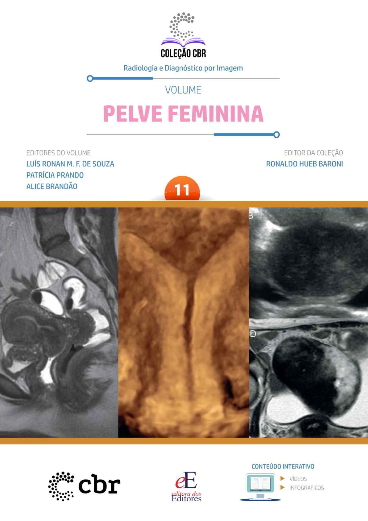 Volume 11 - PELVE FEMININA