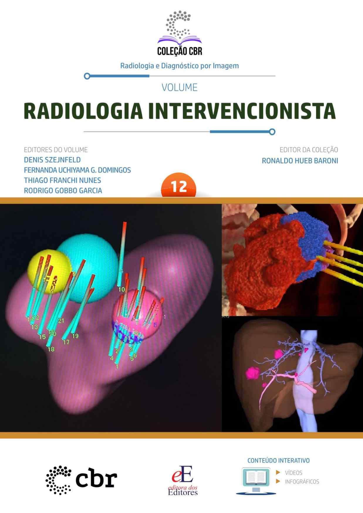 Volume 12 - RADIOLOGIA INTERVENCIONAL