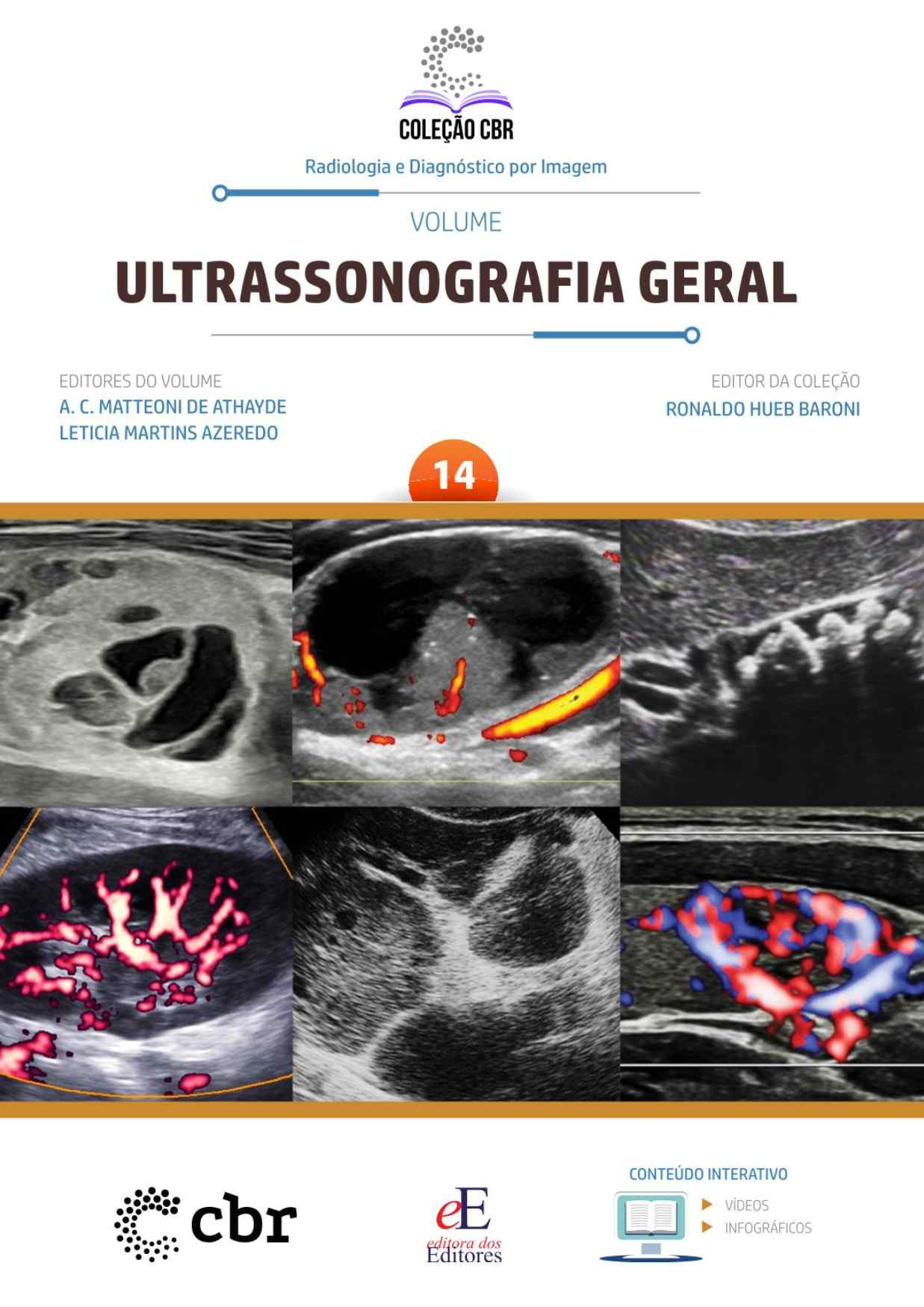 Volume 14 - ULTRASSONOGRAFIA GERAL