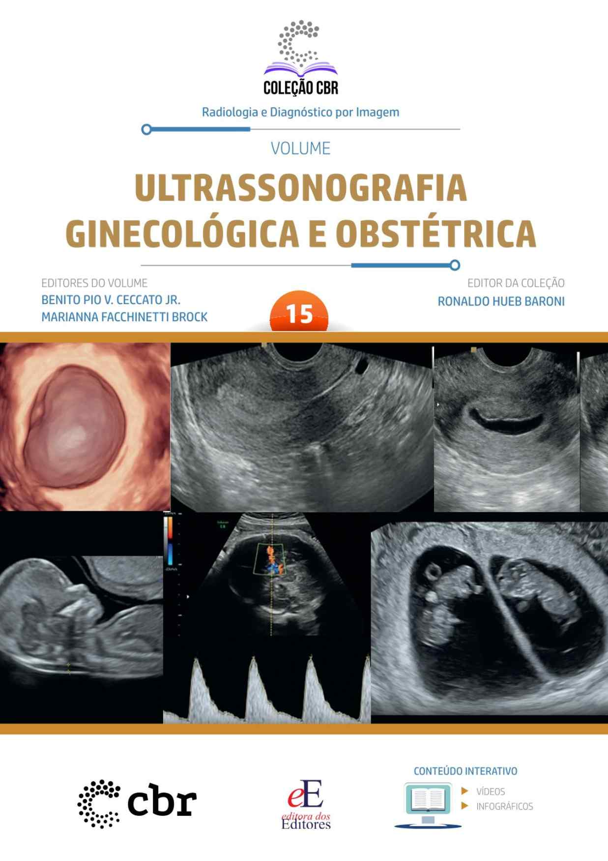 Volume 15 - ULTRASSONOGRAFIA GINECOLÓGICA E OBSTRÉTRICA