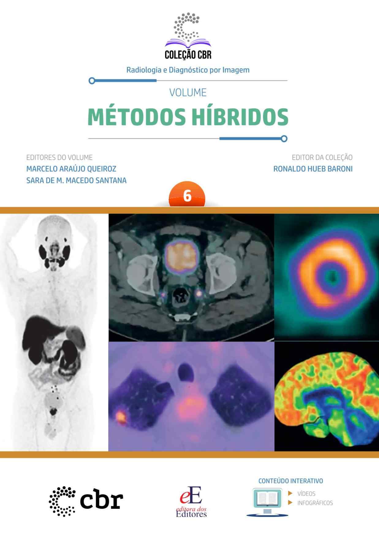 Volume 6 - MÉTODOS HÍBRIDOS