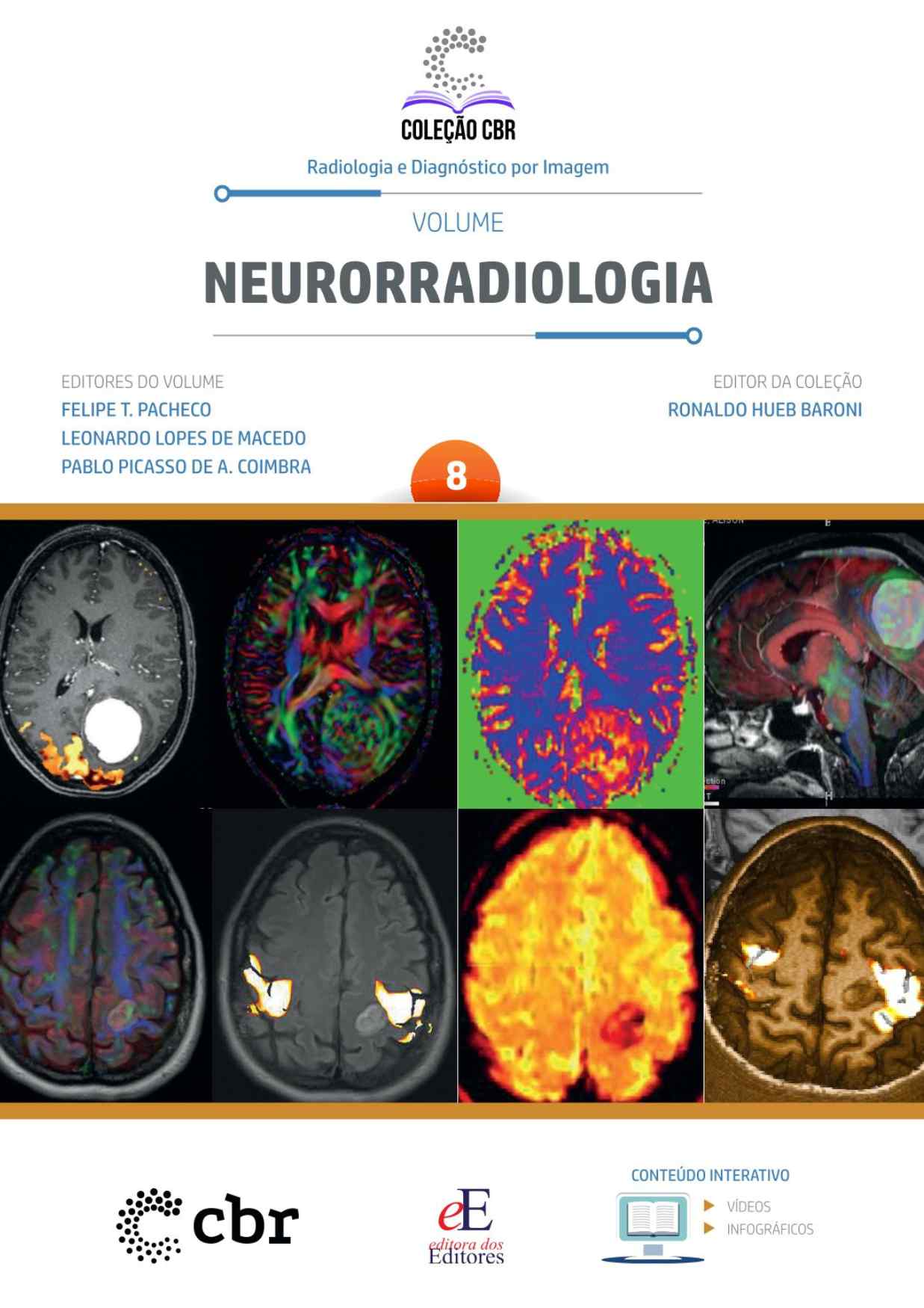 Volume 8 - NEURORRADIOLOGIA