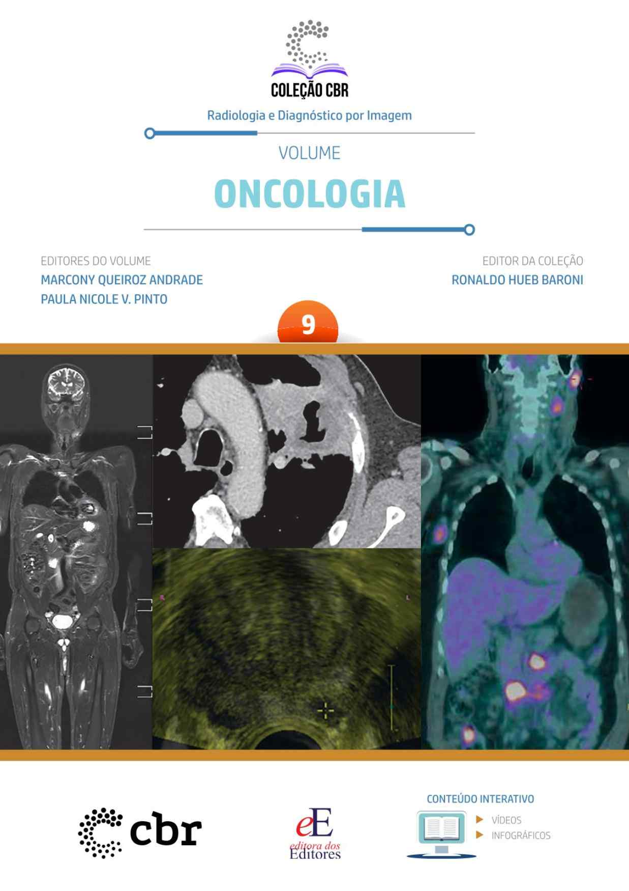 Volume 9 - ONCOLOGIA